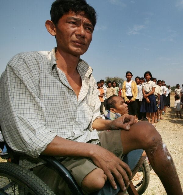 地雷により車椅子生活を強いられた男性。傷口が安定すると義足が着けられるという(写真:橋本 昇)