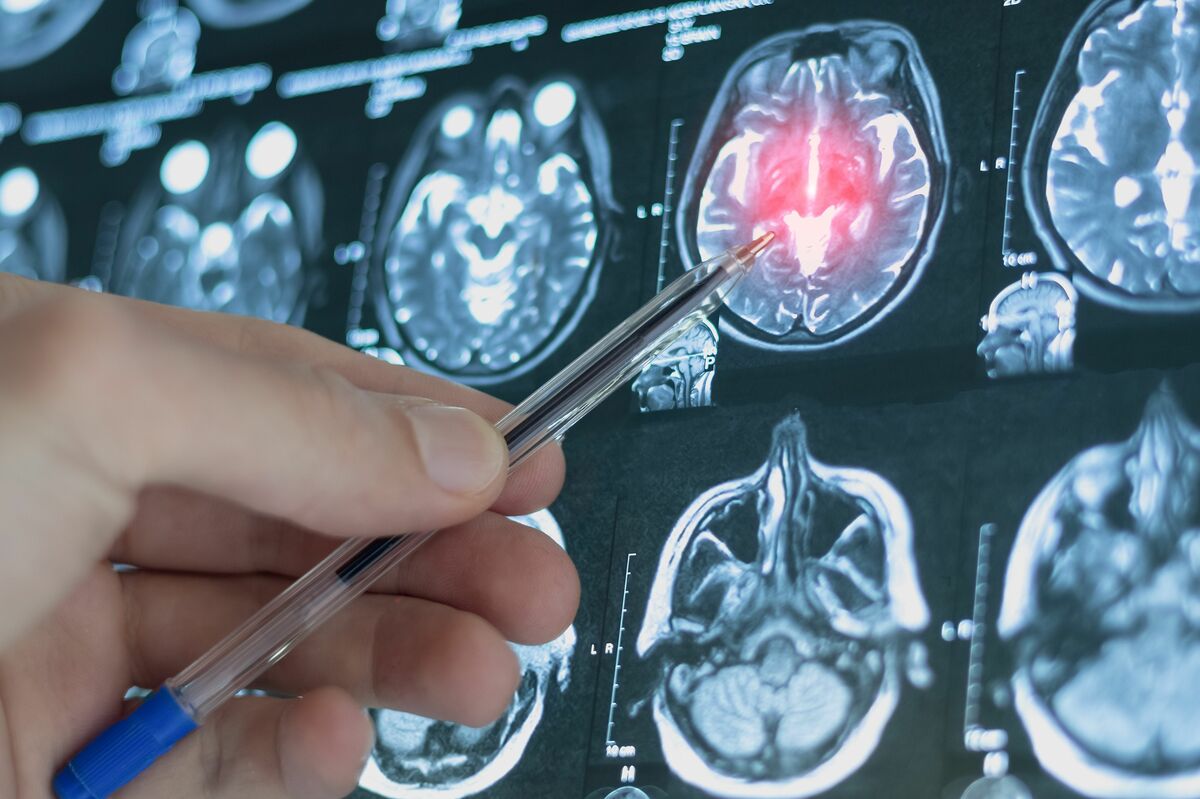 医療現場で具体的かつ劇的な成果を上げているAI、研究の「コパイロット」になる時代に人間に残される2つの役割  【乳がん研究者の視点】AIと進化する知はどこに向かうか、求められる学習と専門性を再定義(1/4) | JBpress (ジェイビープレス)